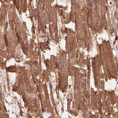 CRYM Antibody in Immunohistochemistry (IHC)