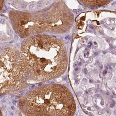 CRYM Antibody in Immunohistochemistry (IHC)