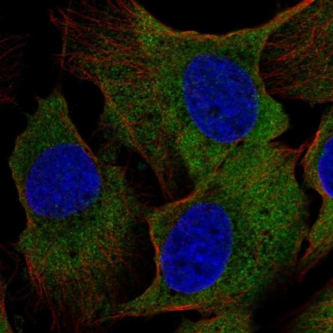 CRYM Antibody in Immunocytochemistry (ICC/IF)