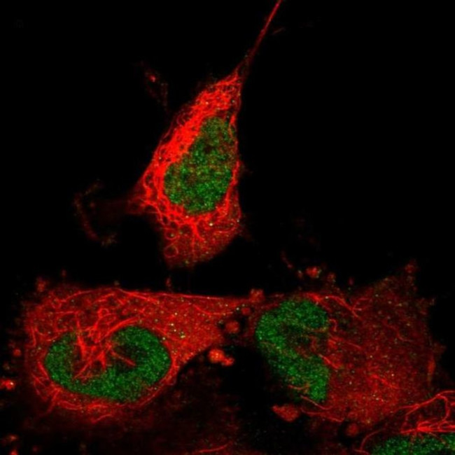 ABTB2 Antibody in Immunocytochemistry (ICC/IF)