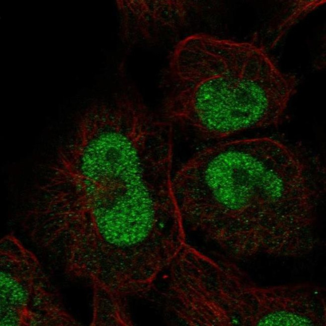 ZNF667 Antibody in Immunocytochemistry (ICC/IF)