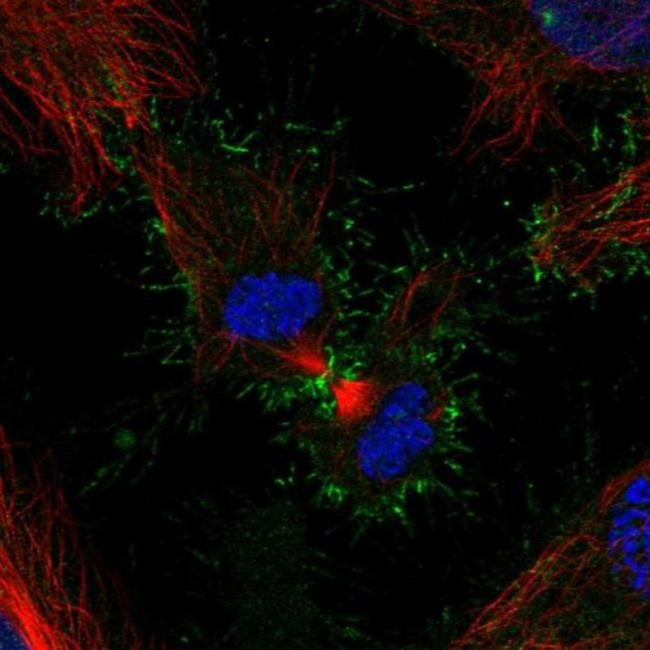 PSCA Antibody in Immunocytochemistry (ICC/IF)