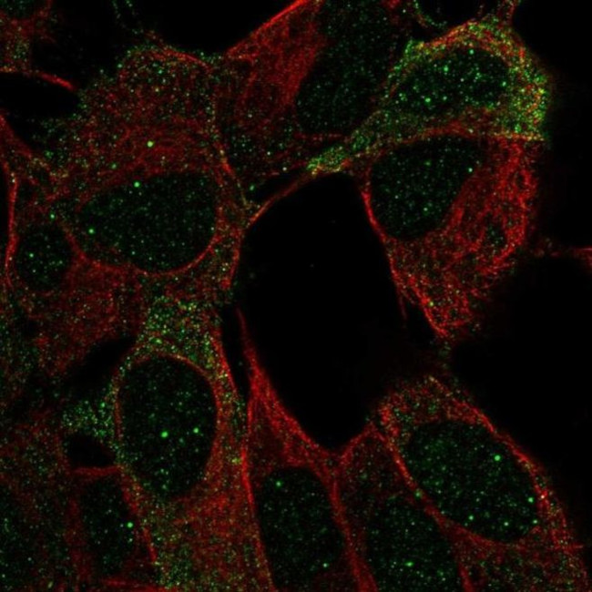 NCAM2 Antibody in Immunocytochemistry (ICC/IF)