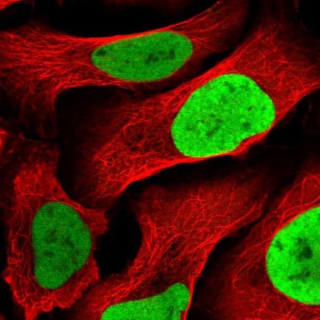 MCM4 Antibody in Immunocytochemistry (ICC/IF)