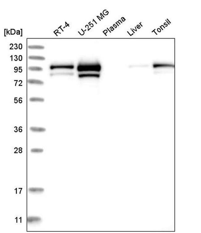 MCM4 Antibody in Western Blot (WB)