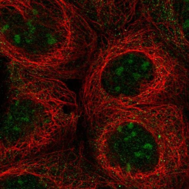 UBXD5 Antibody in Immunocytochemistry (ICC/IF)