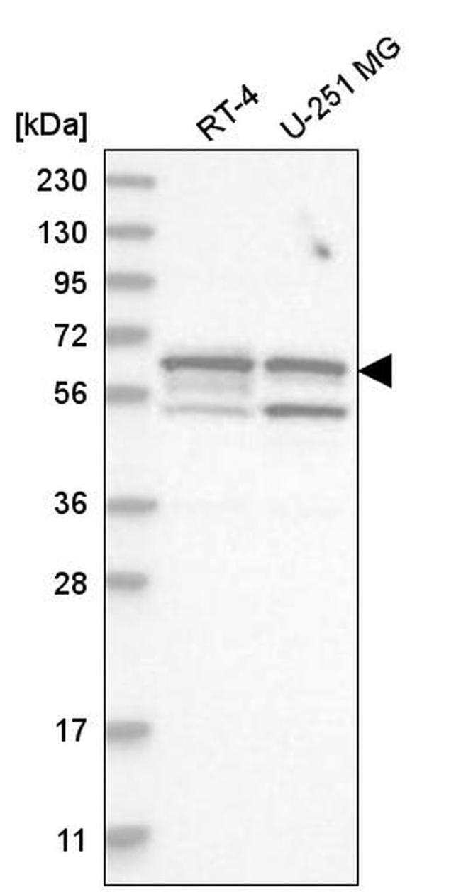 SHC3 Antibody in Western Blot (WB)
