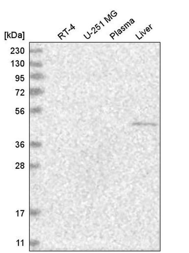 GCNF Antibody in Western Blot (WB)