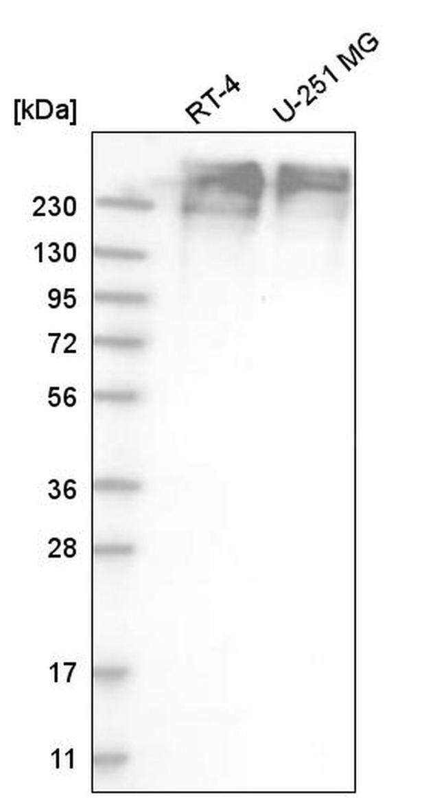 SON Antibody in Western Blot (WB)