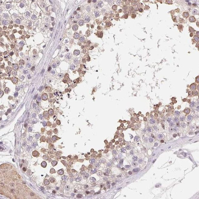 LCA5L Antibody in Immunohistochemistry (IHC)