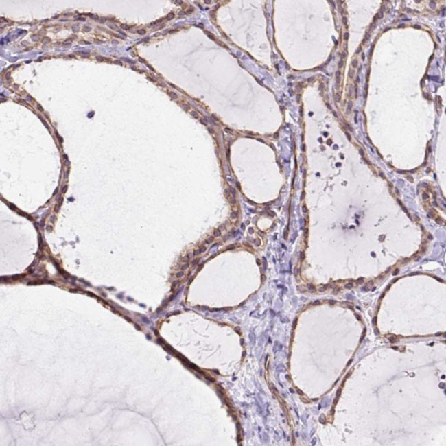 MYO5C Antibody in Immunohistochemistry (IHC)