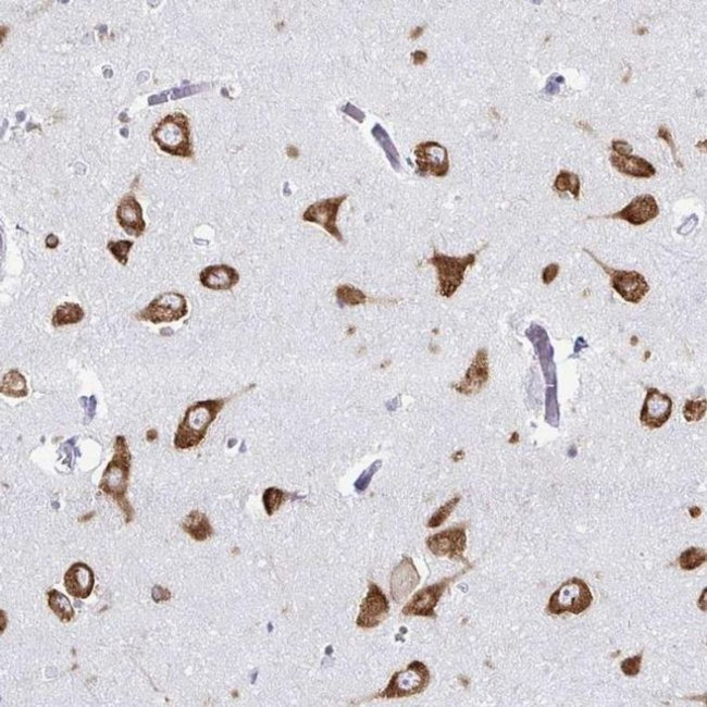 PACT Antibody in Immunohistochemistry (IHC)