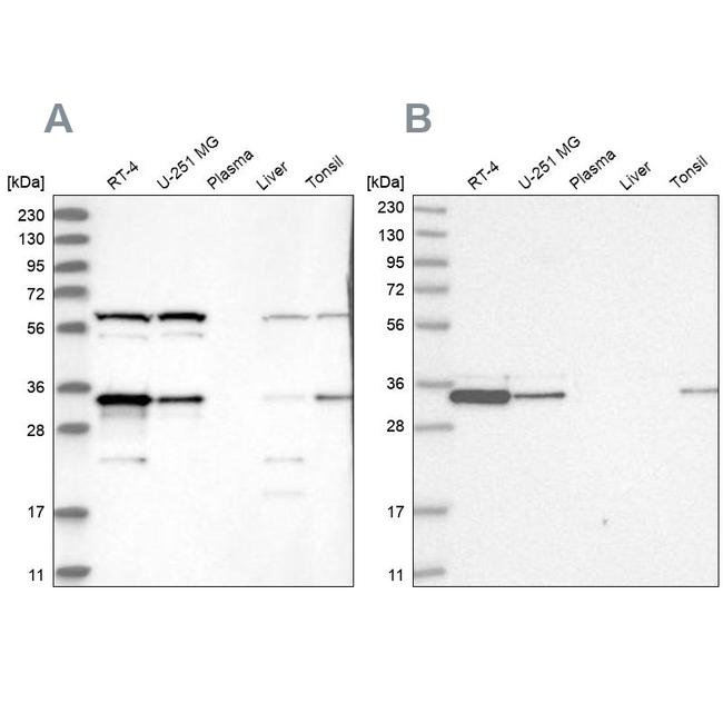 PACT Antibody in Western Blot (WB)