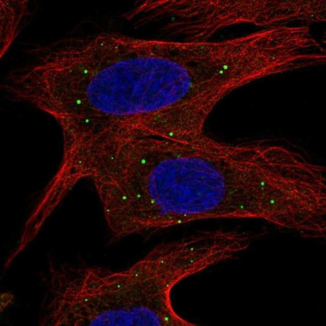 ABCB9 Antibody in Immunocytochemistry (ICC/IF)