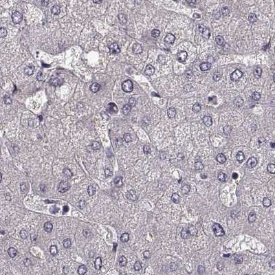 GRK1 Antibody in Immunohistochemistry (IHC)