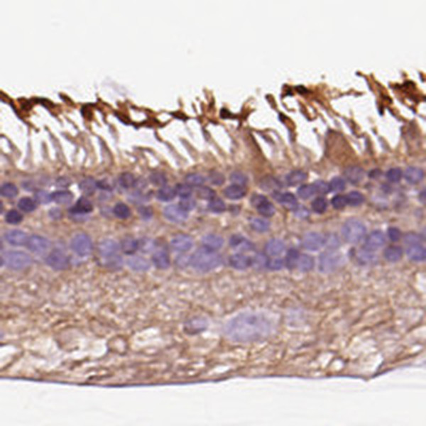 GRK1 Antibody in Immunohistochemistry (IHC)