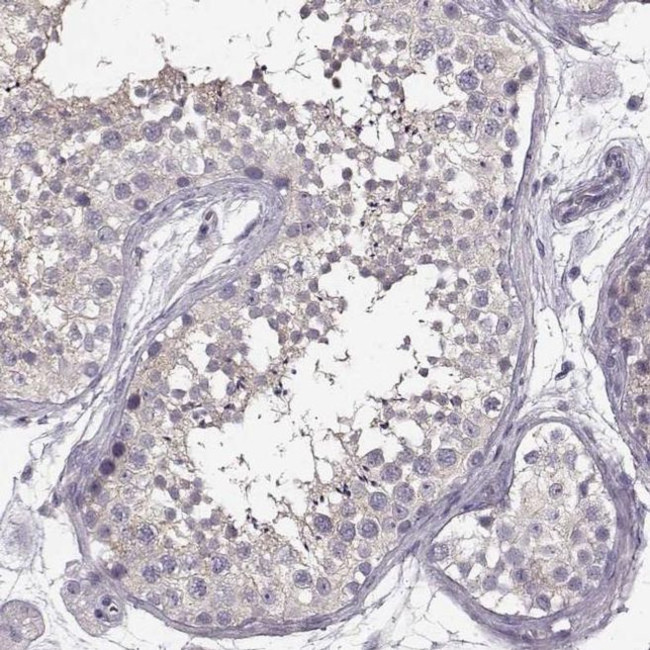 GRK1 Antibody in Immunohistochemistry (IHC)