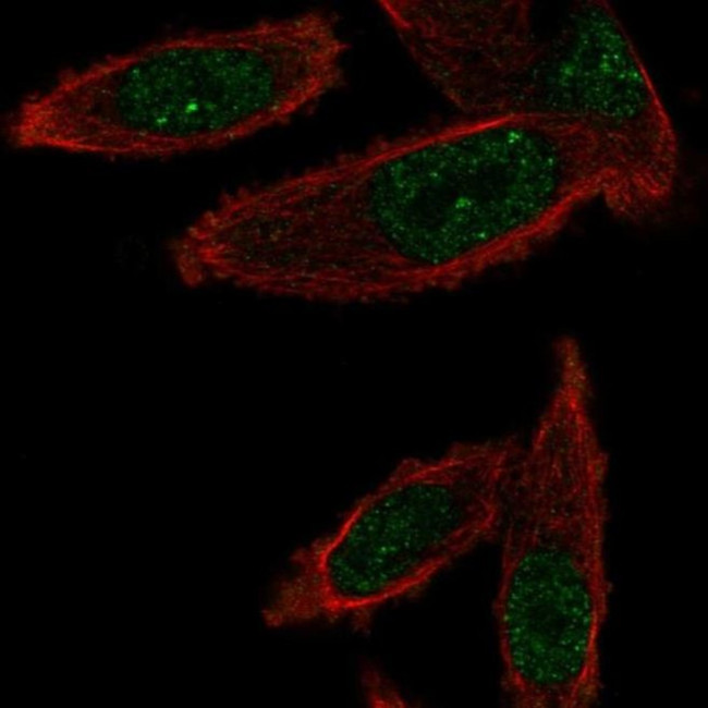 Gemin 6 Antibody in Immunocytochemistry (ICC/IF)