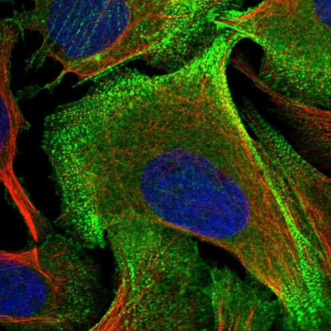 Palladin Antibody in Immunocytochemistry (ICC/IF)