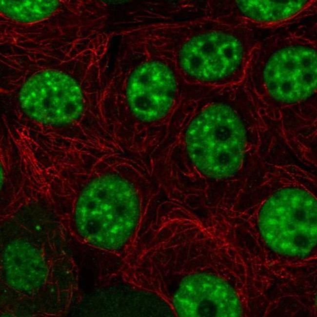 HELQ Antibody in Immunocytochemistry (ICC/IF)