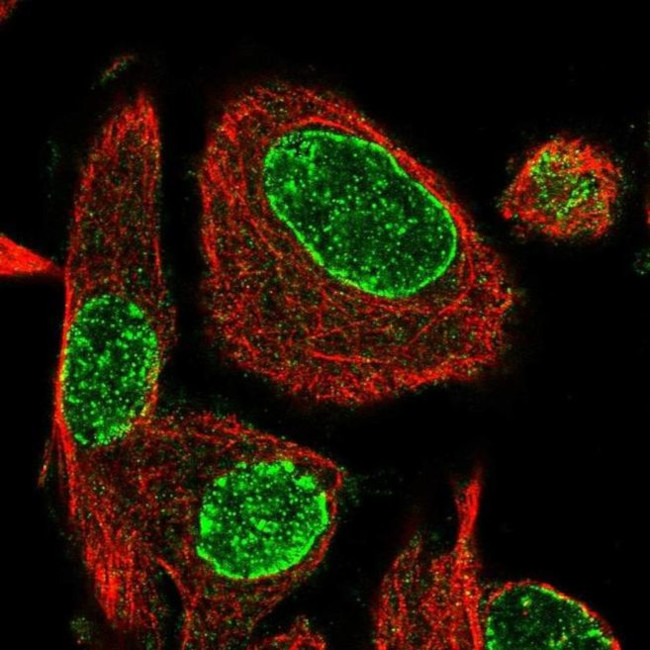 ADPRH Antibody in Immunocytochemistry (ICC/IF)