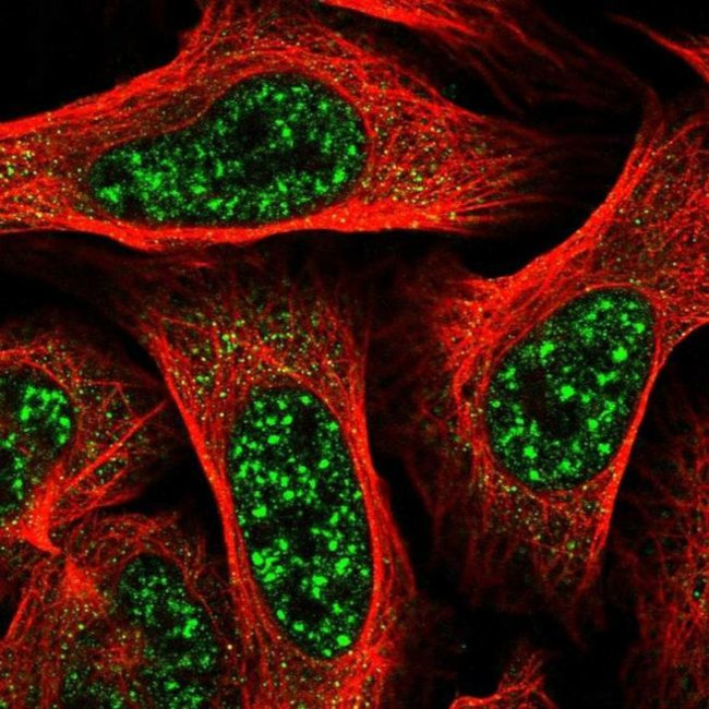 TBC1D8 Antibody in Immunocytochemistry (ICC/IF)