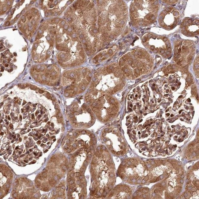 COPG Antibody in Immunohistochemistry (IHC)