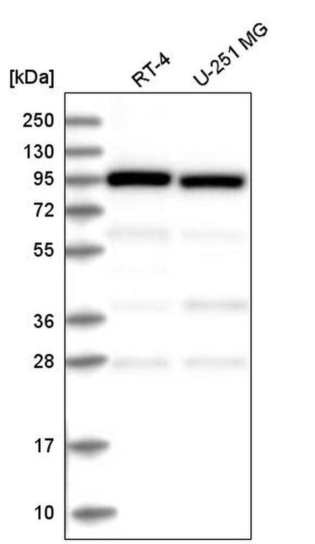 COPG Antibody in Western Blot (WB)