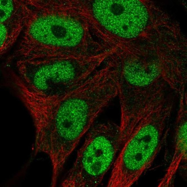 GAL3ST4 Antibody in Immunocytochemistry (ICC/IF)