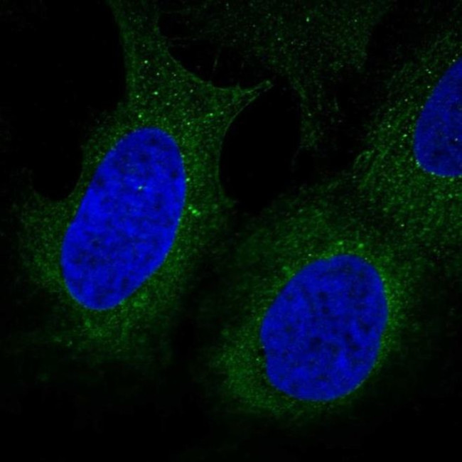 DIP2B Antibody in Immunocytochemistry (ICC/IF)