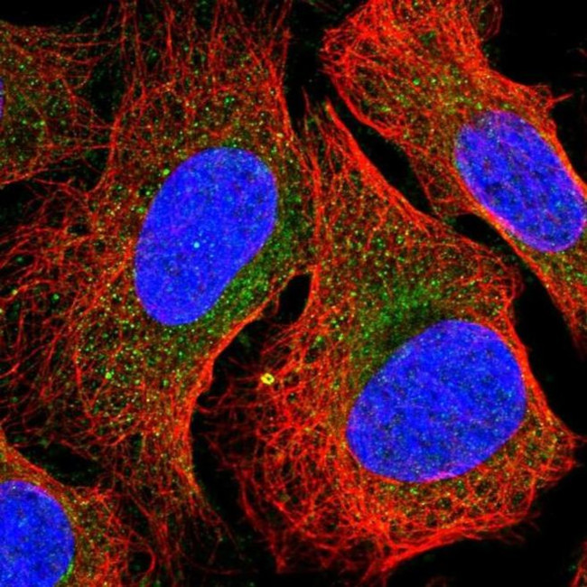 NADSYN1 Antibody in Immunocytochemistry (ICC/IF)