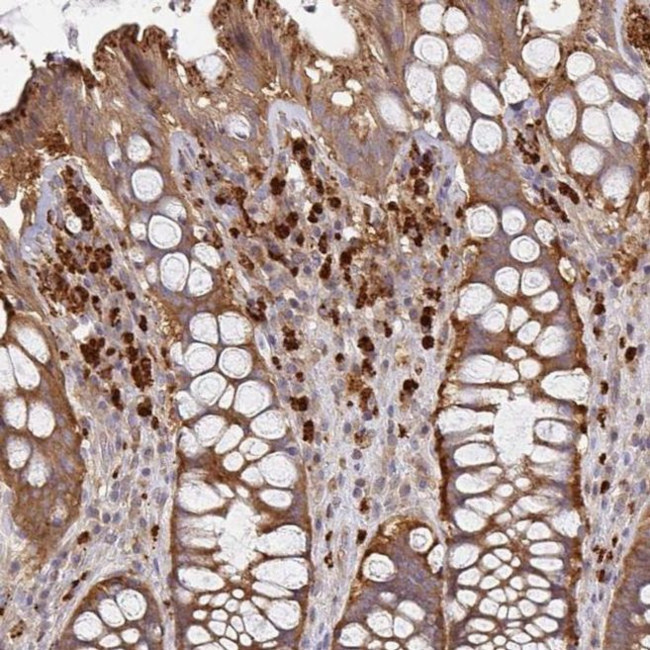 NADSYN1 Antibody in Immunohistochemistry (IHC)