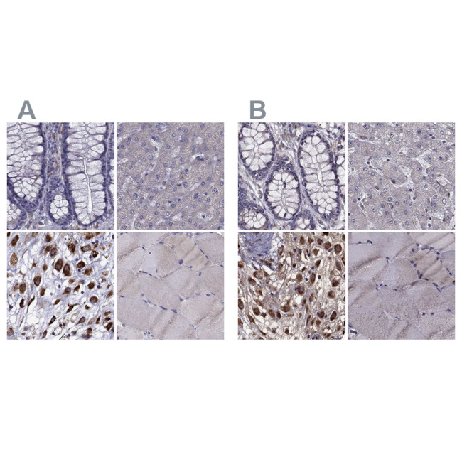 IKBIP Antibody in Immunohistochemistry (IHC)