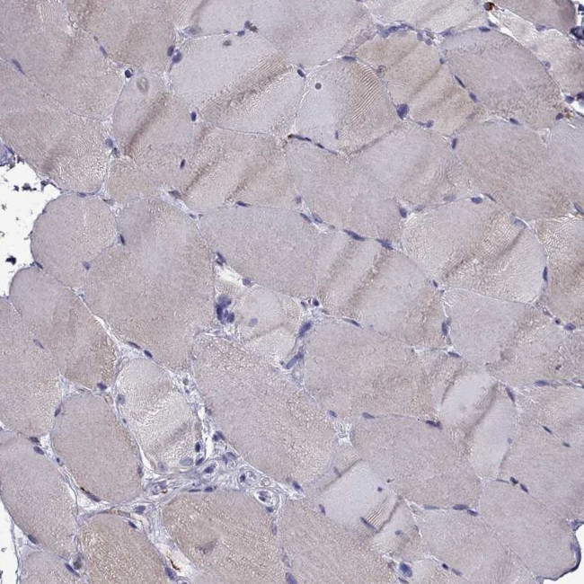 IKBIP Antibody in Immunohistochemistry (IHC)