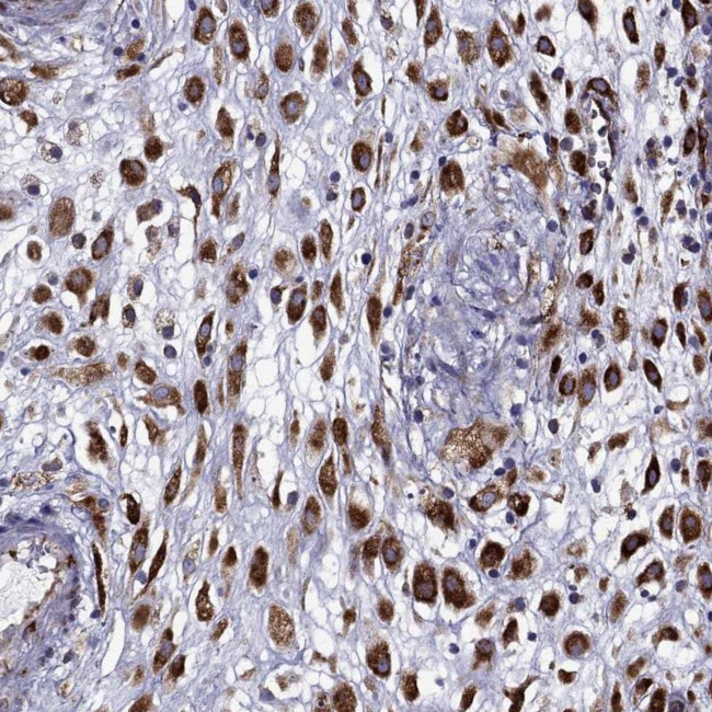 IKBIP Antibody in Immunohistochemistry (IHC)