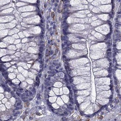 IKBIP Antibody in Immunohistochemistry (IHC)