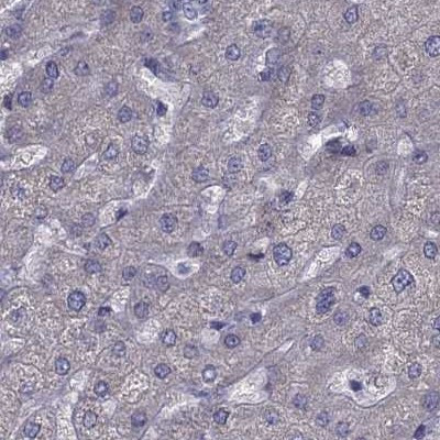 IKBIP Antibody in Immunohistochemistry (IHC)