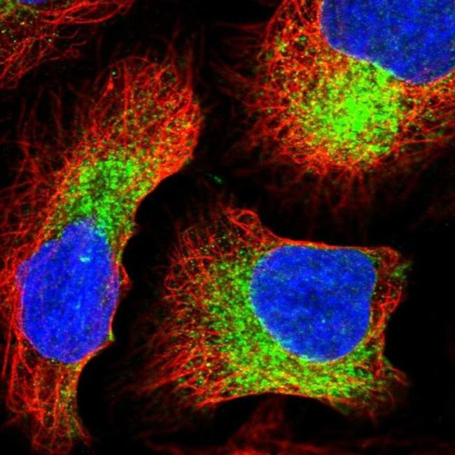 IKBIP Antibody in Immunocytochemistry (ICC/IF)