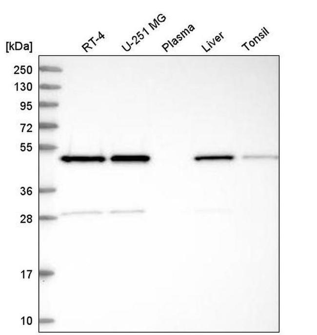 IKBIP Antibody in Western Blot (WB)