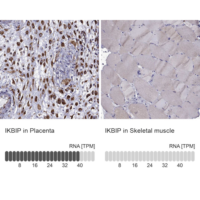 IKBIP Antibody