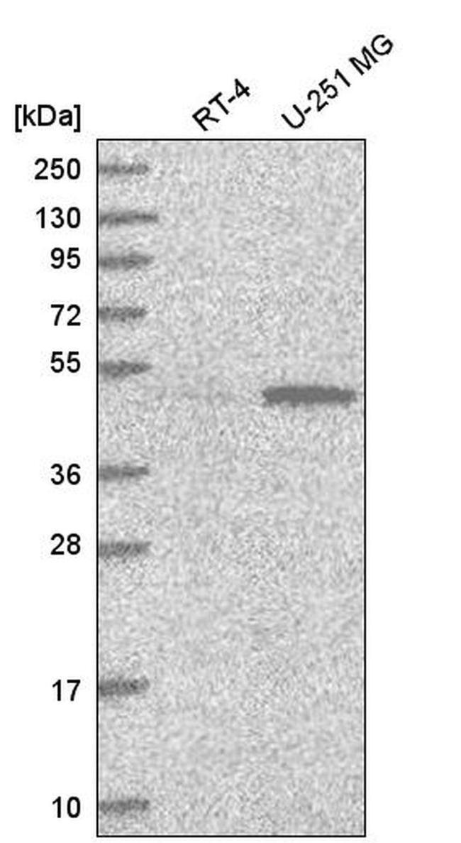 PWP1 Antibody in Western Blot (WB)