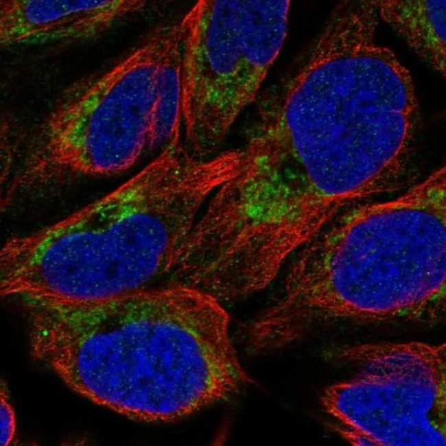 NMNAT3 Antibody in Immunocytochemistry (ICC/IF)