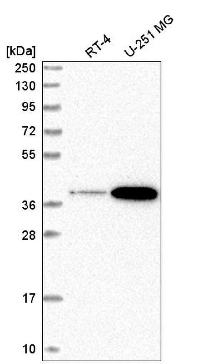 SPPL2B Antibody in Western Blot (WB)