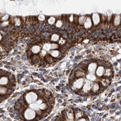 SUCLA2 Antibody in Immunohistochemistry (IHC)