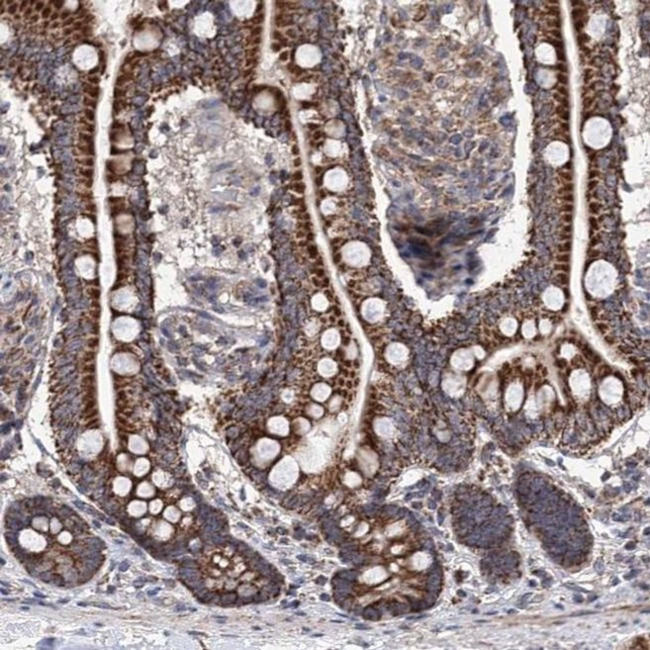 SUCLA2 Antibody in Immunohistochemistry (IHC)