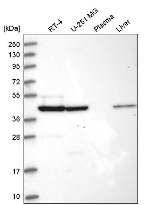 SUCLA2 Antibody in Western Blot (WB)