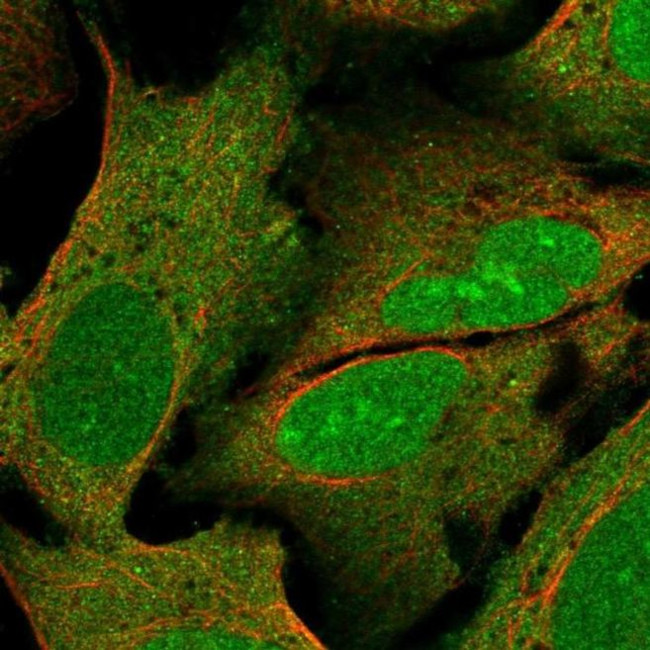 WIBG Antibody in Immunocytochemistry (ICC/IF)