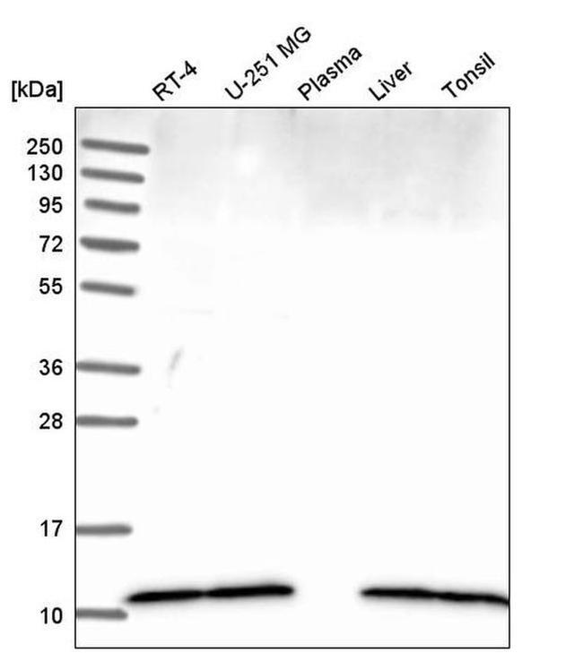 DYNLL1 Antibody in Western Blot (WB)