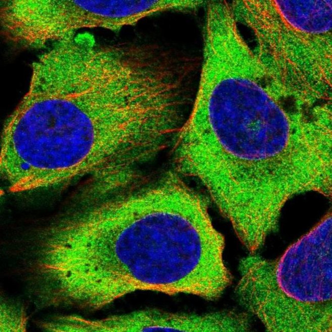 eIF5B Antibody in Immunocytochemistry (ICC/IF)