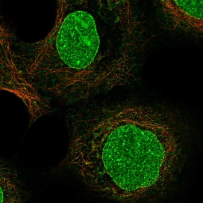 ZDHHC16 Antibody in Immunocytochemistry (ICC/IF)